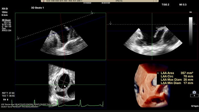 EPIQ CVx -TrueVue Glass with 3D Auto LAA