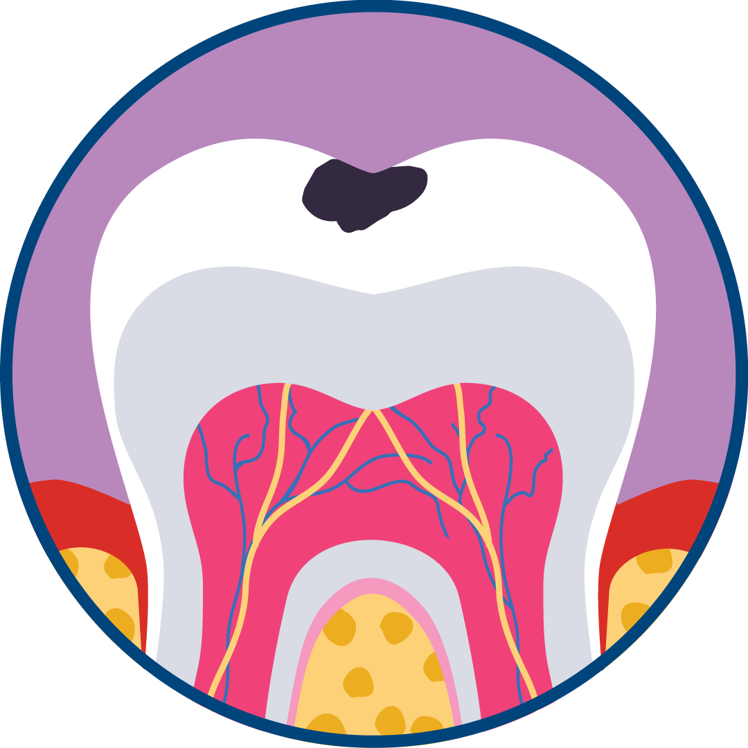 Fog&aacute;szati probl&eacute;m&aacute;k jele