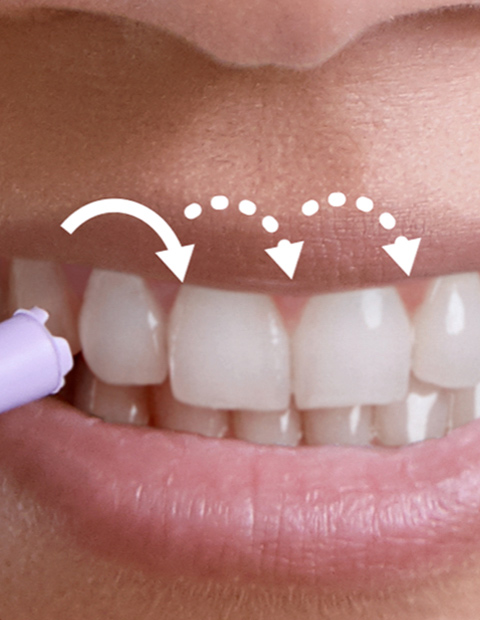 Pulse wave technol&oacute;gia