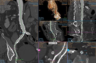 multi modality tumor tracking qeasl