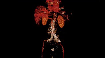 spectral advanced vessel analysis